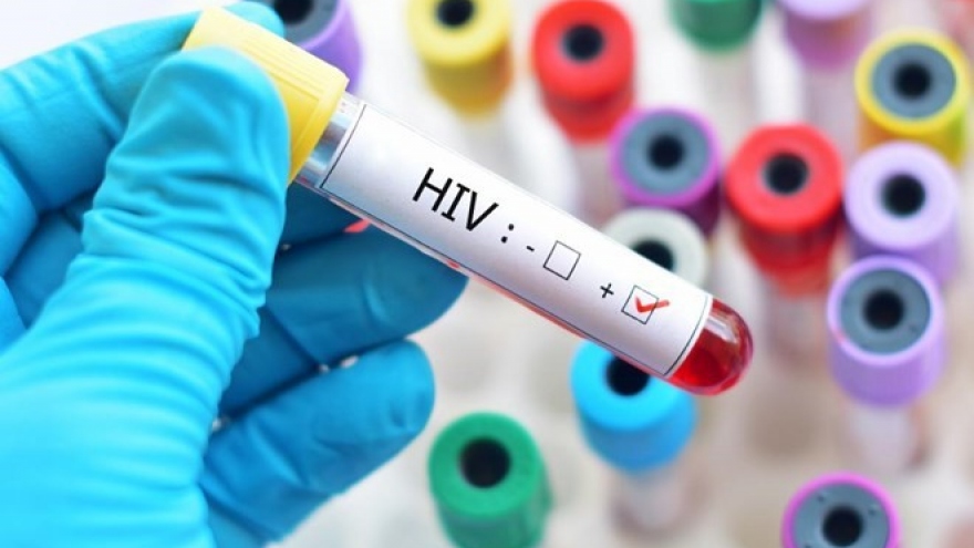 Hanoi detects 1,263 HIV cases over ten-month period