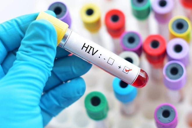 Hanoi detects 1,263 HIV cases over ten-month period