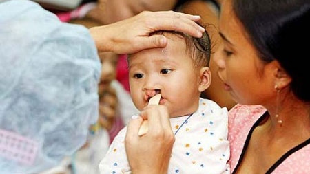 Free surgery for children with facial deformities